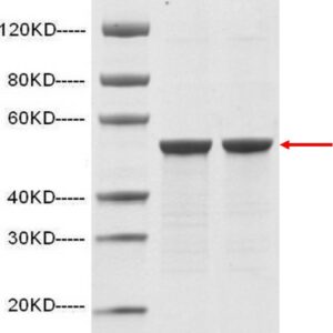 SARS-CoV-2 Nucleocapsid protein (His Tag)
