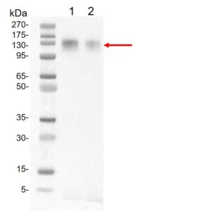 SARS-CoV-2 Spike protein (S1)
